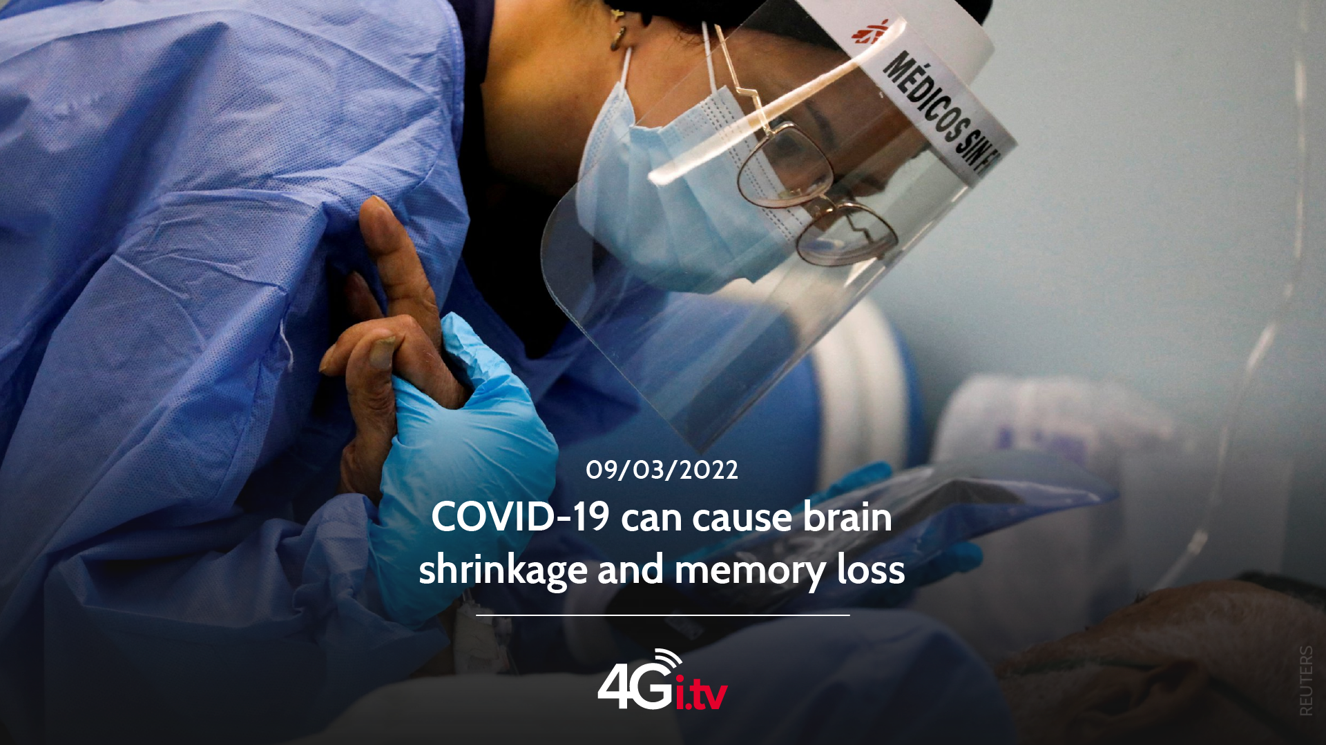 Read more about the article COVID-19 can cause brain shrinkage and memory loss