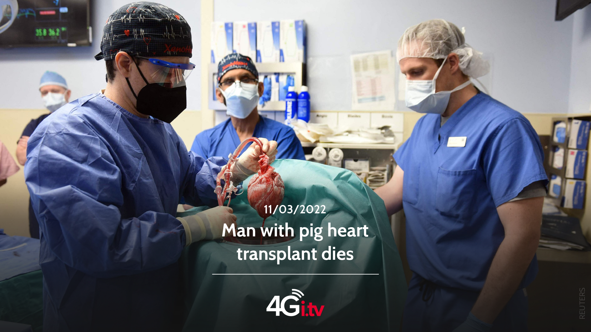 Read more about the article Man with pig heart transplant dies