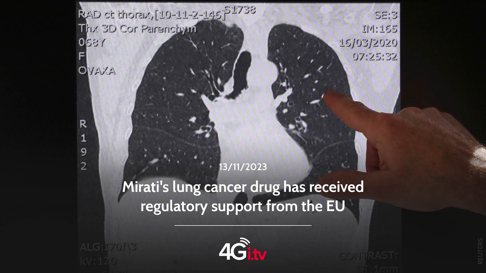 Read more about the article Mirati’s lung cancer drug has received regulatory support from the EU