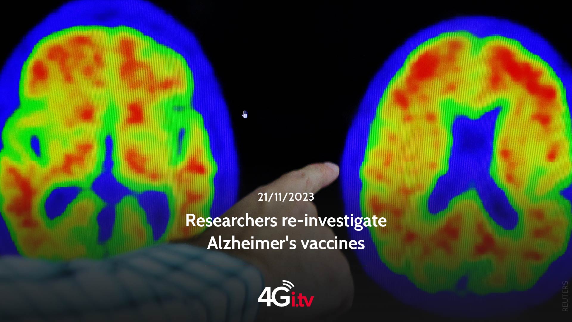 Lesen Sie mehr über den Artikel Researchers re-investigate Alzheimer’s vaccines