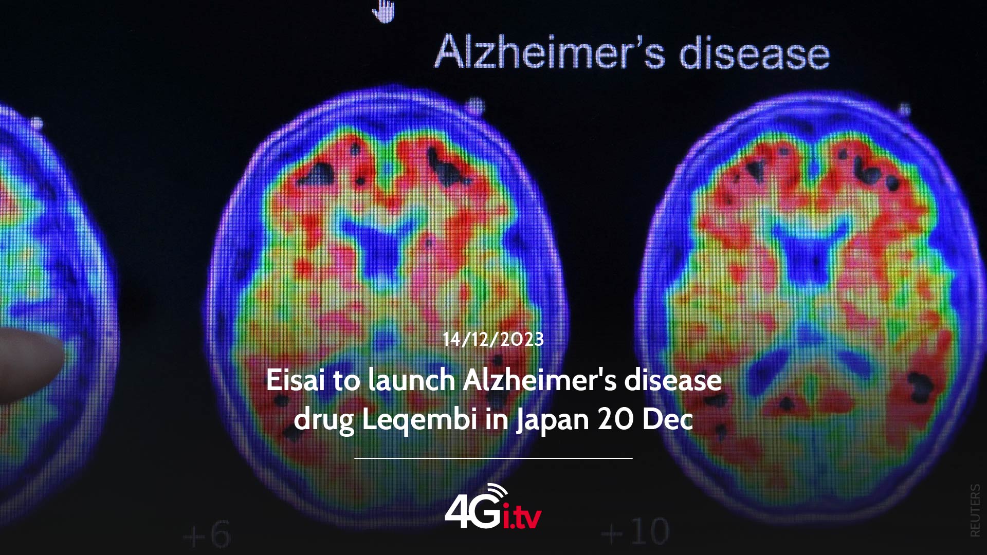 Read more about the article Eisai to launch Alzheimer’s disease drug Leqembi in Japan 20 Dec