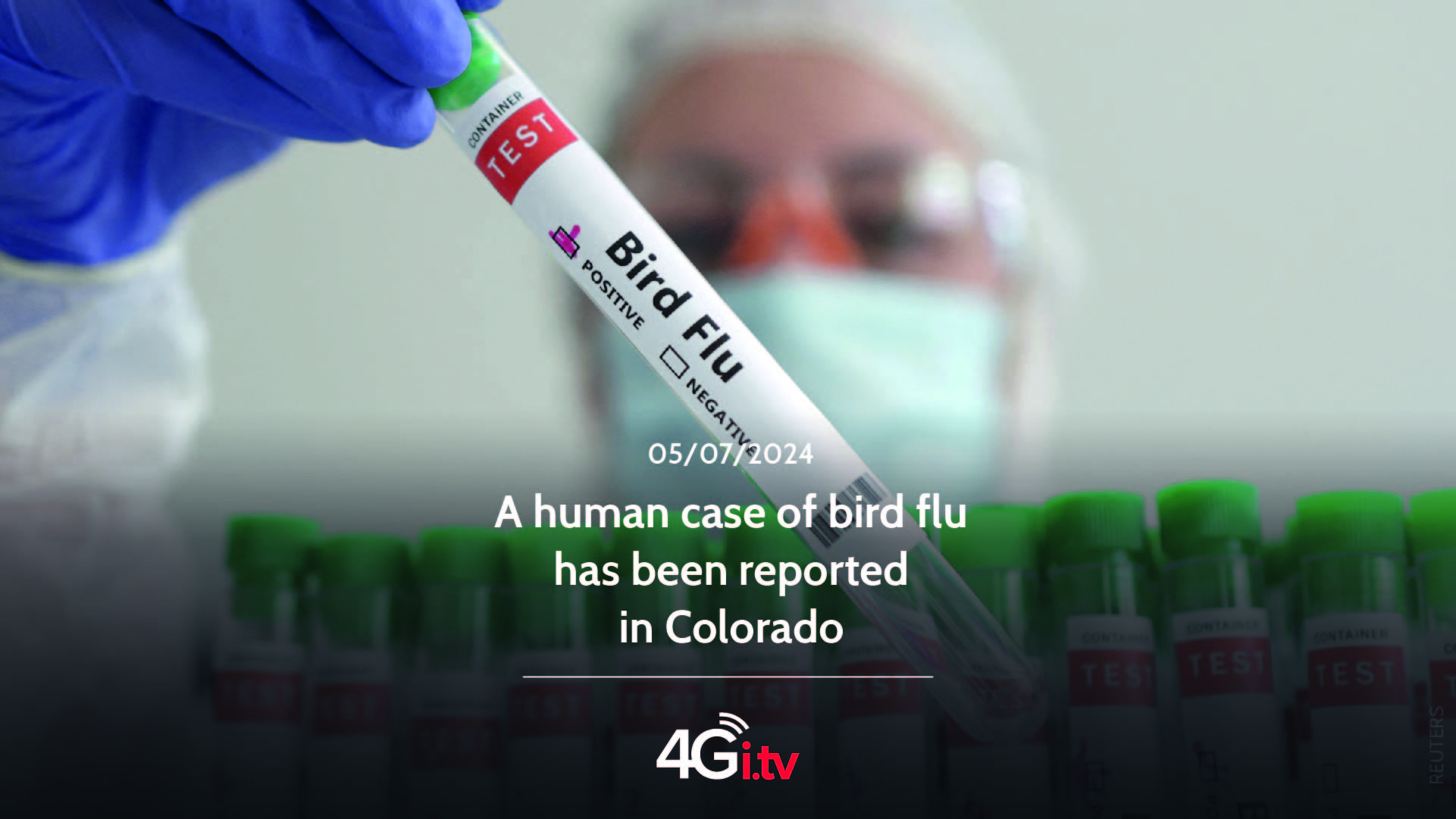 Read more about the article A human case of bird flu has been reported in Colorado