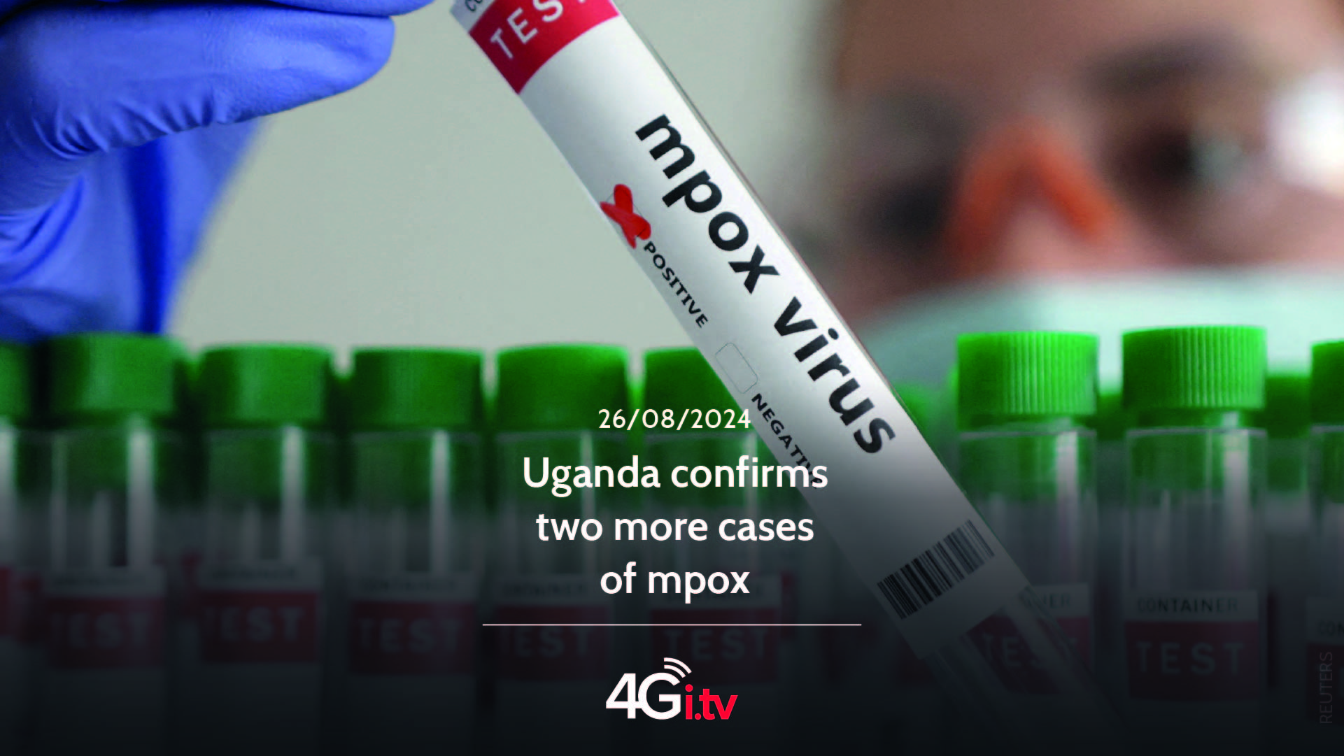 Подробнее о статье Uganda confirms two more cases of mpox