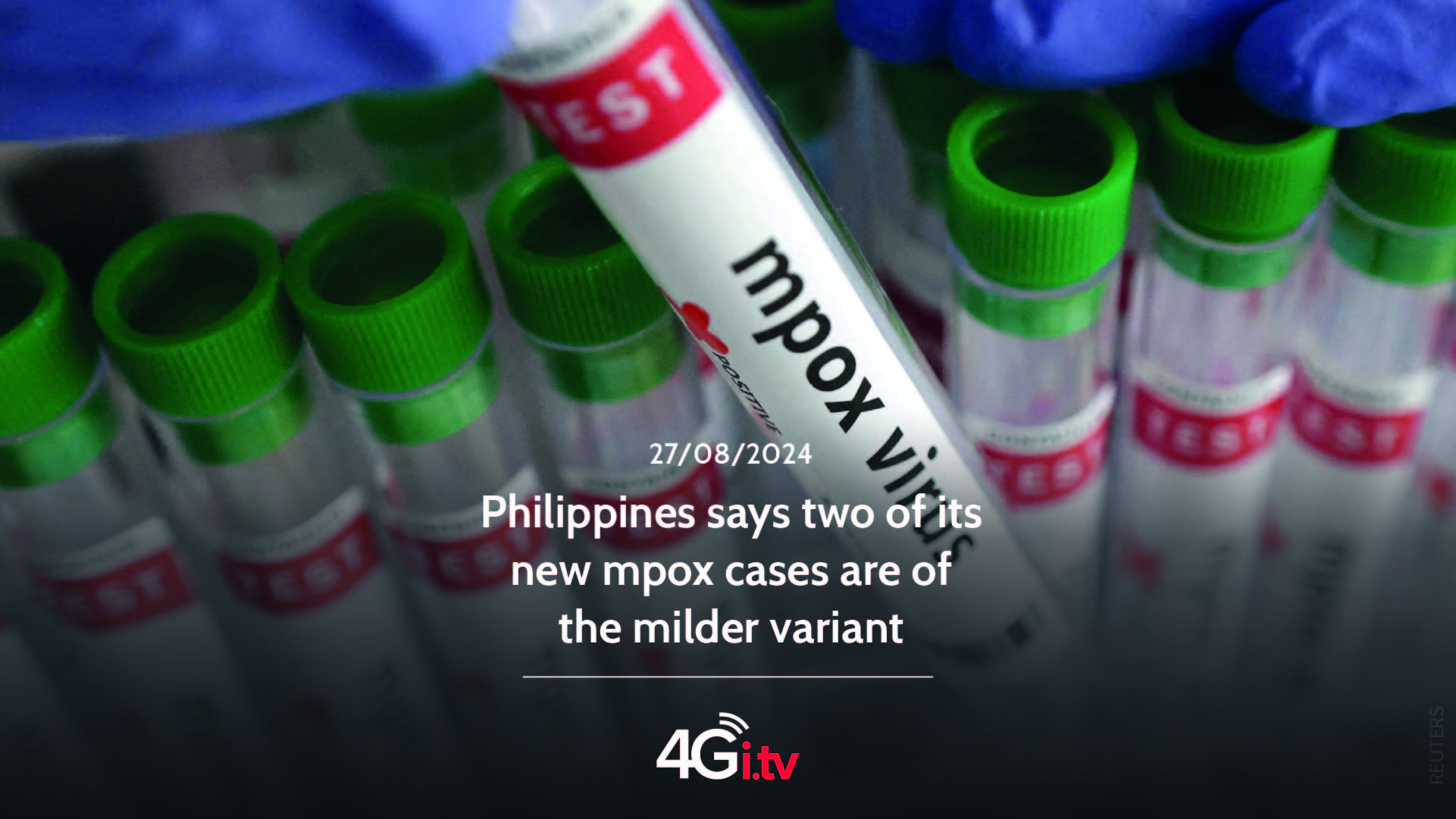 Read more about the article Philippines says two of its new mpox cases are of the milder variant