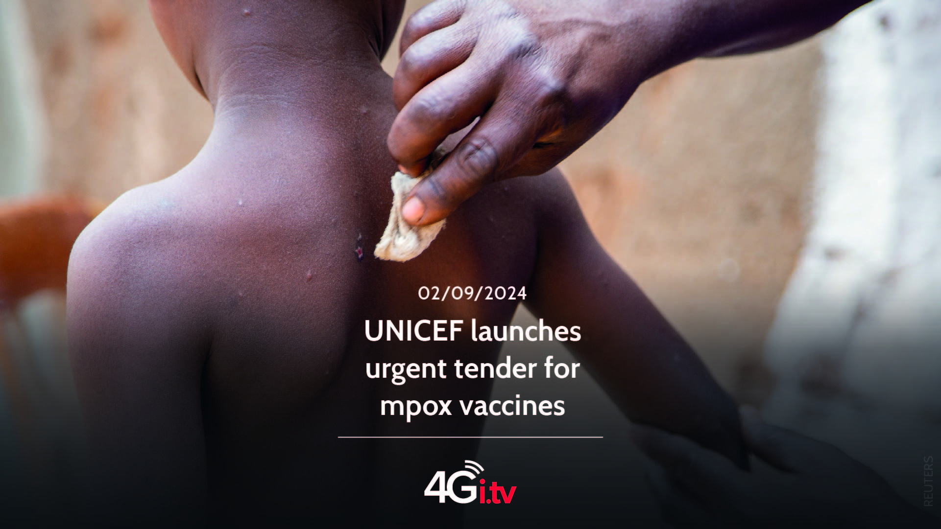 Подробнее о статье UNICEF launches urgent tender for mpox vaccines