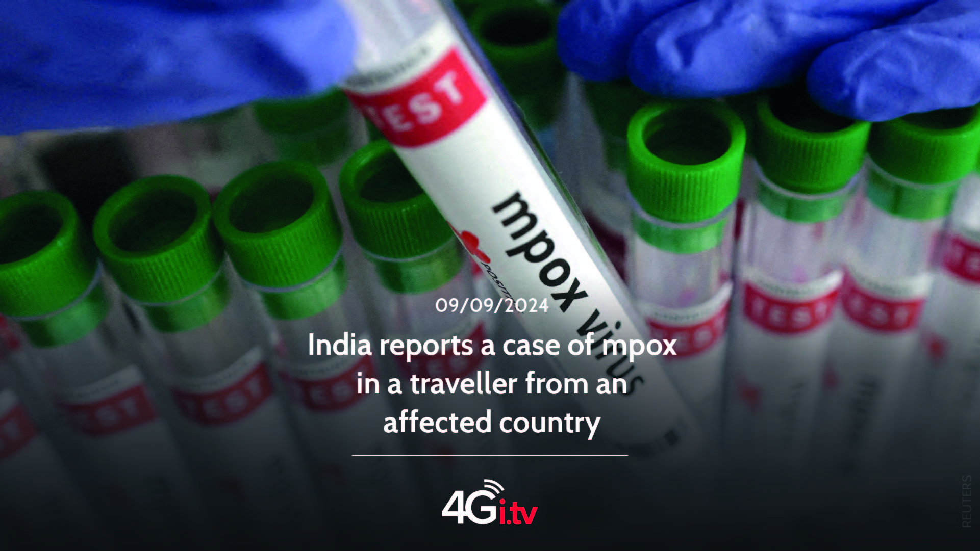 Lee más sobre el artículo India reports a case of mpox in a traveller from an affected country