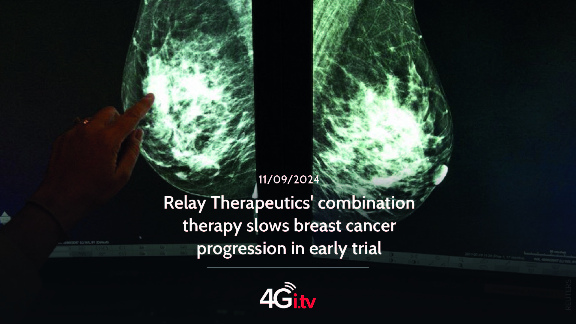 Подробнее о статье Relay Therapeutics’ combination therapy slows breast cancer progression in early trial