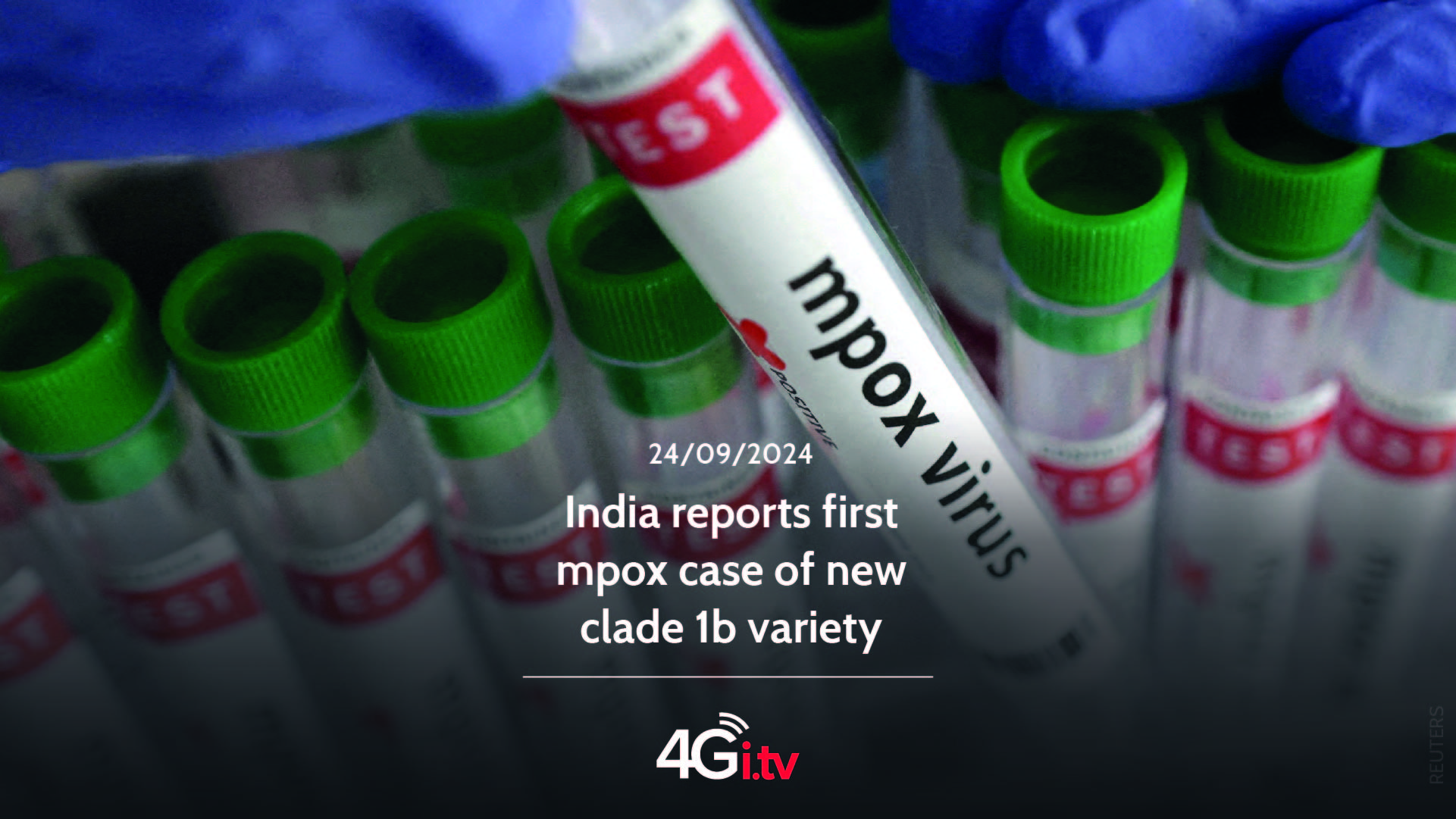 Lesen Sie mehr über den Artikel India reports first mpox case of new clade 1b variety