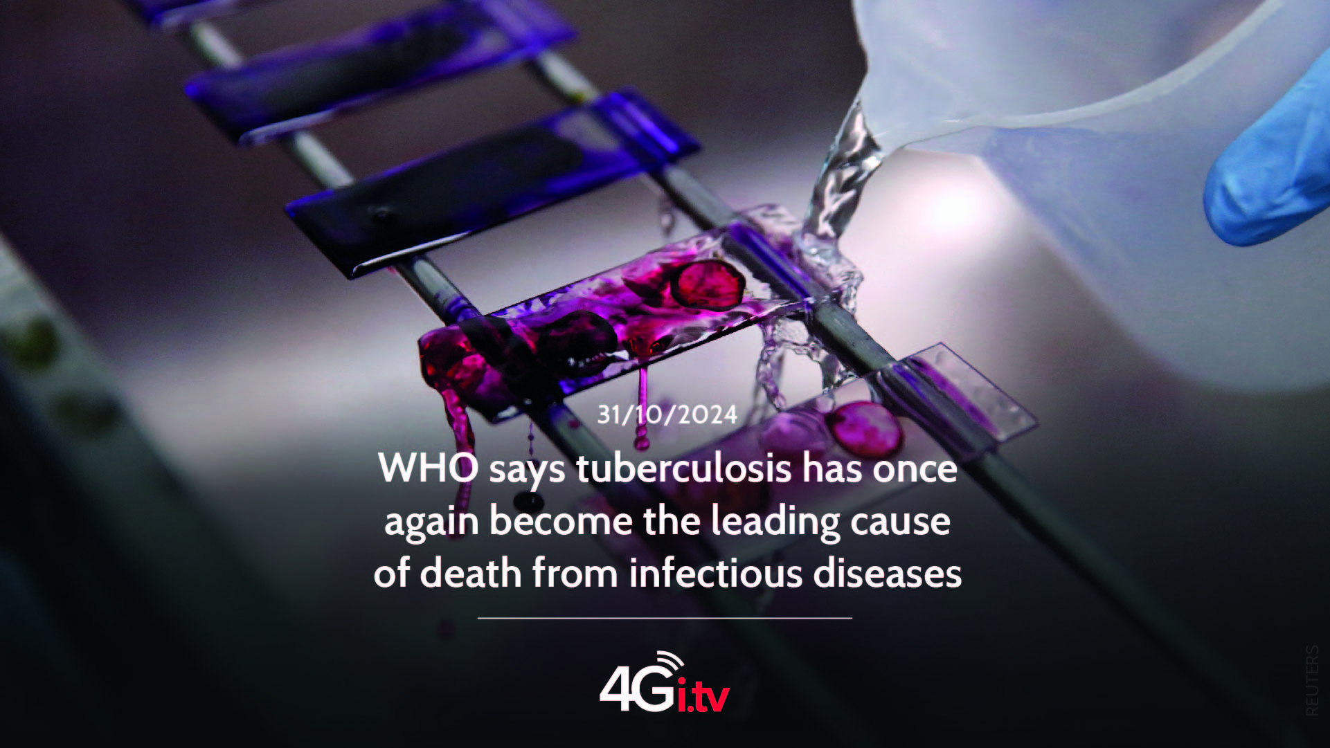 Lesen Sie mehr über den Artikel WHO says tuberculosis has once again become the leading cause of death from infectious diseases