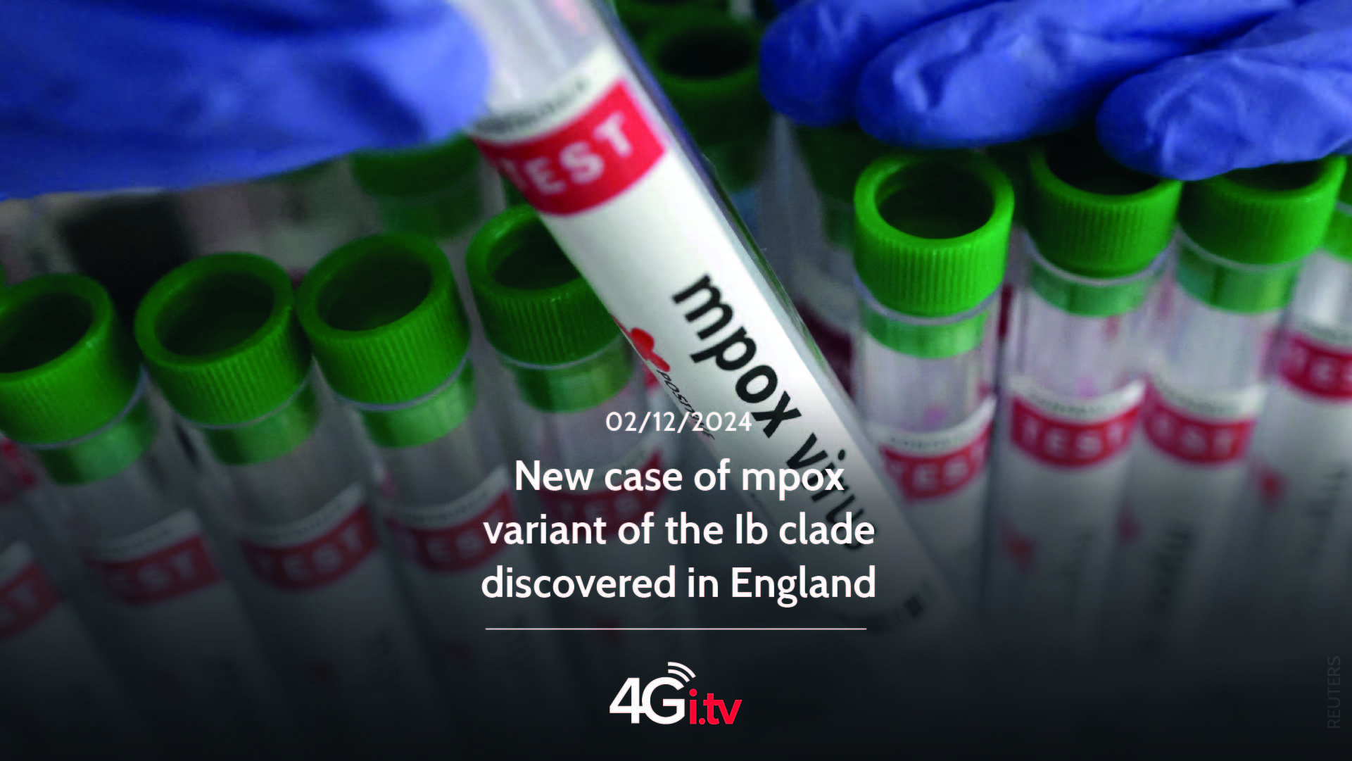 Lesen Sie mehr über den Artikel New case of mpox variant of the Ib clade discovered in England 